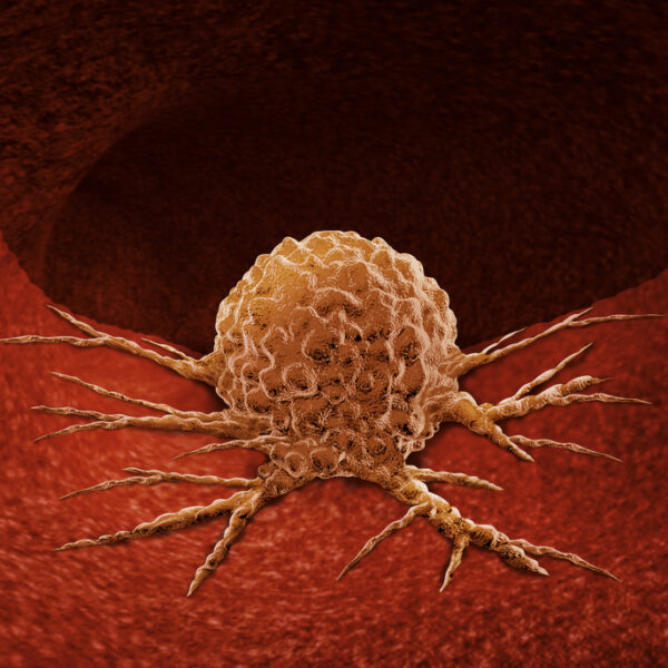 cancer cell - deposit photos